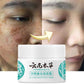Dr Hancy White Spot Cream