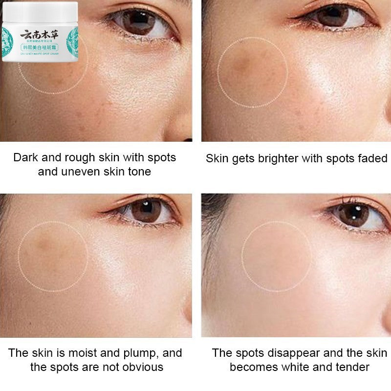 Dr Hancy White Spot Cream