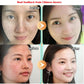 Dr Hancy White Spot Cream